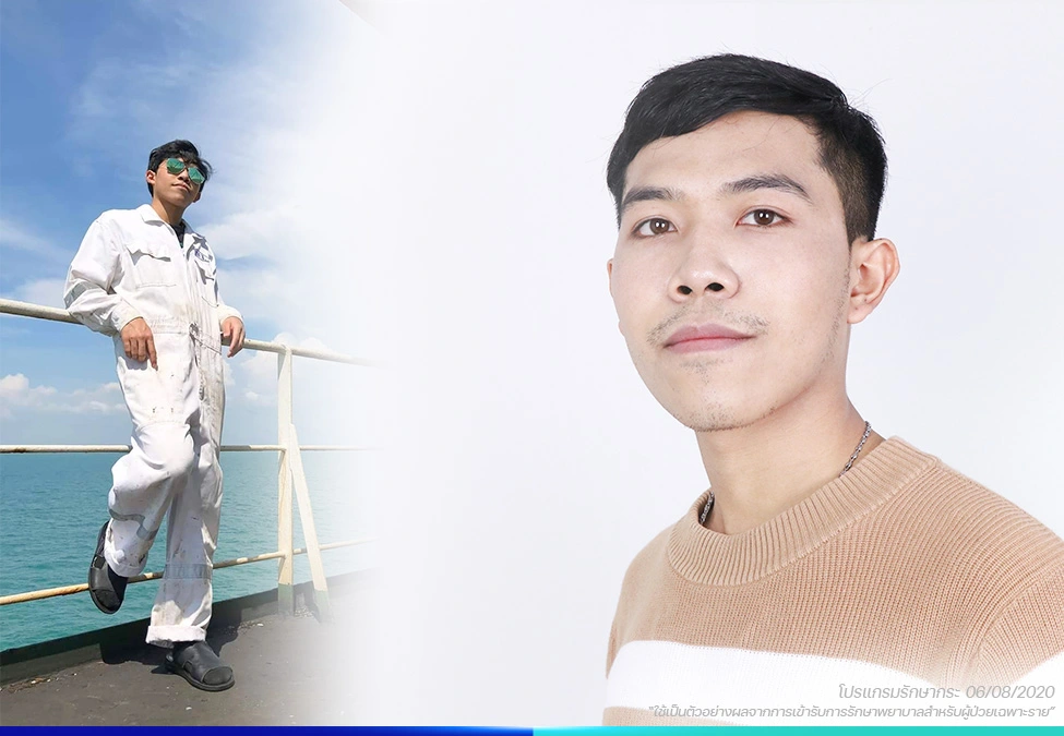 รักษากระ