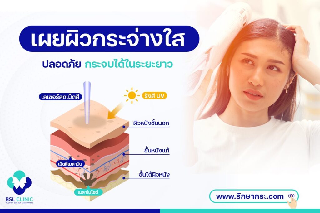 วิธีรักษากระ